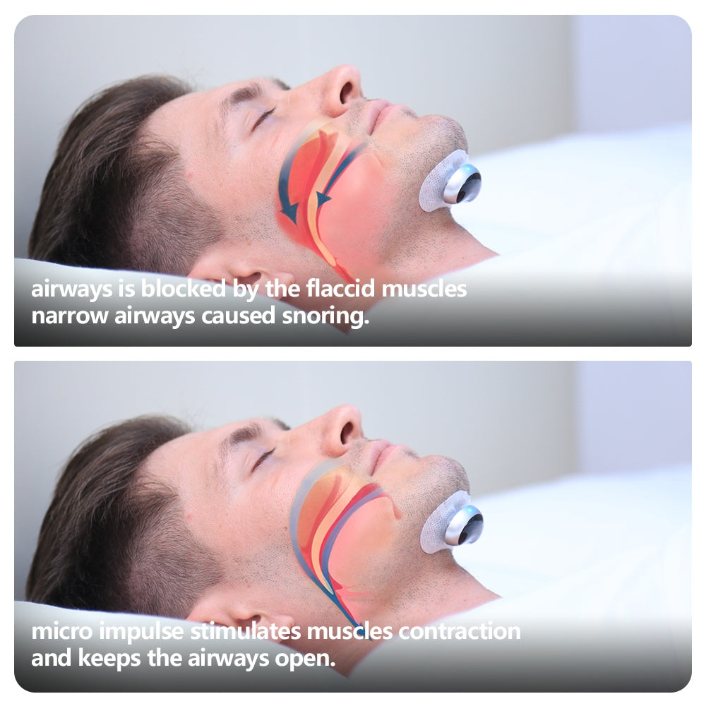 Anti Snoring Device | EMS Anti Snoring Device | In My Aura