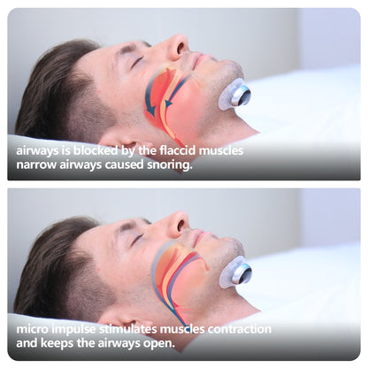 Anti Snoring Device | EMS Anti Snoring Device | In My Aura